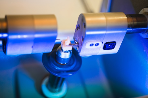 From Consultation To Care: What You Should Know About CEREC Crowns