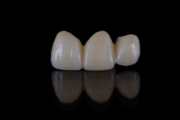 Ways To Take Care Of Your Dental Bridge