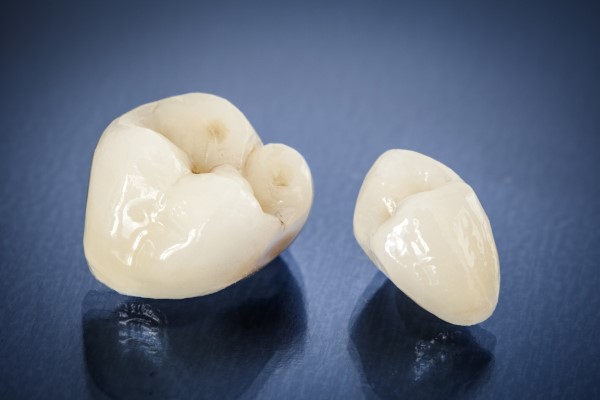 The Steps Of A Dental Crown Restoration
