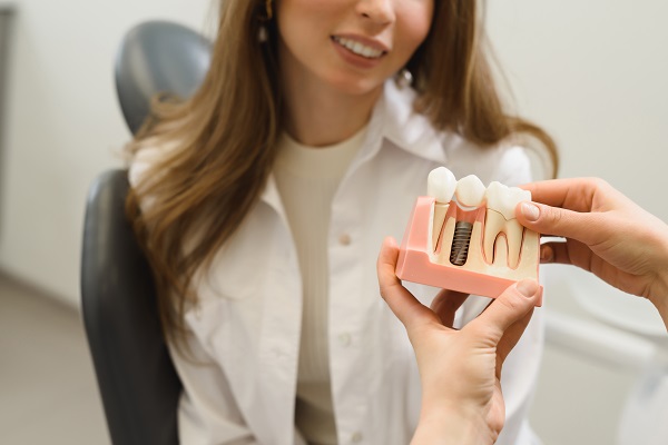 FAQs About The Process For Dental Implants