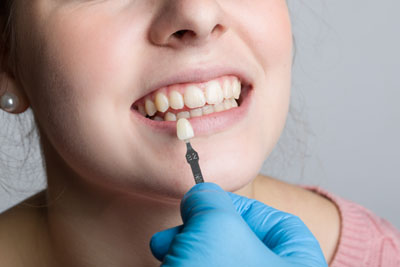 A Lumineers Dentist Can Give You A Wedding Smile Makeover