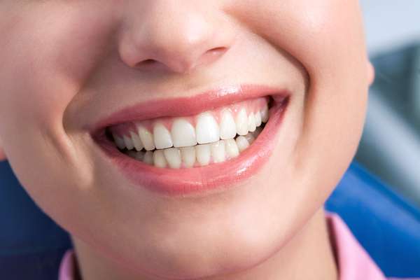 A General Dentist Discusses the Benefits of Tooth Straightening from South Florida Dental Arts in Miami, FL