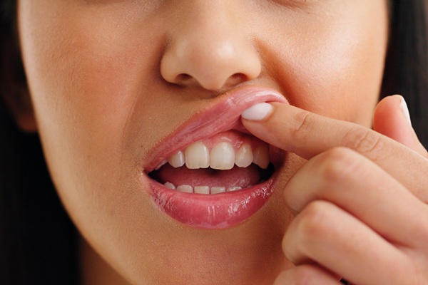 Gum Disease Treatment Options From A Family Dentist