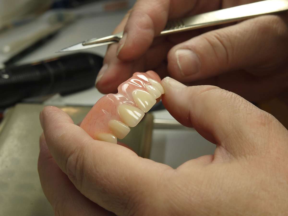 Determining The Best Way To Replace Missing Teeth