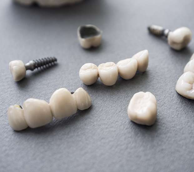 Miami The Difference Between Dental Implants and Mini Dental Implants