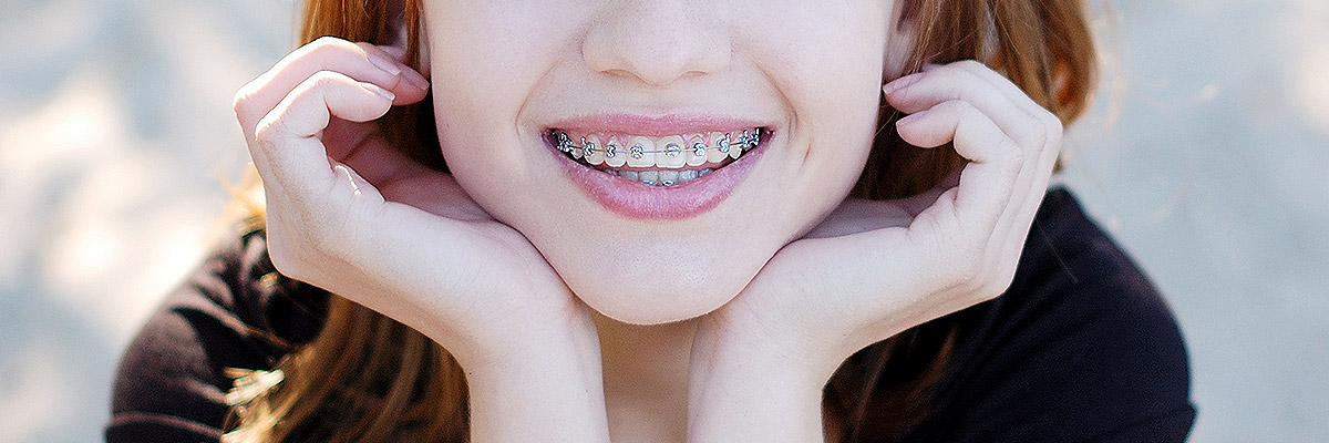 Miami Orthodontics