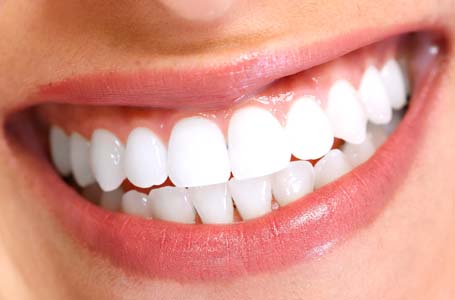 Ways To Keep Your Porcelain Veneer In Good Condition
