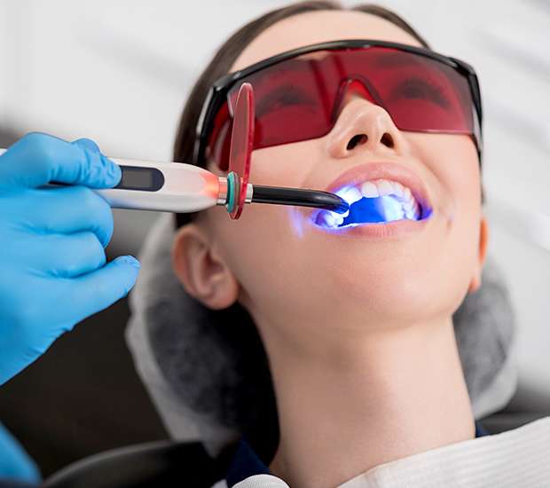 Miami Professional Teeth Whitening