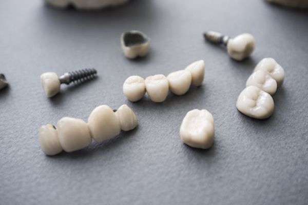 Types of Dental Implants from South Florida Dental Arts in Miami, FL